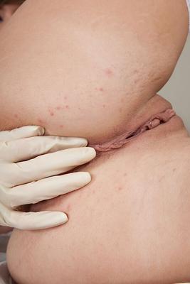 16P ストッキングを履いた誘惑的な看護師が脱いでパイパンマンコをからかう