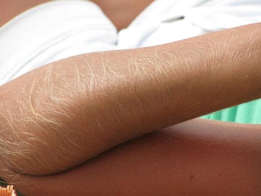 14P Amateur model Lori Anderson shows her her really hair arms while at the beach