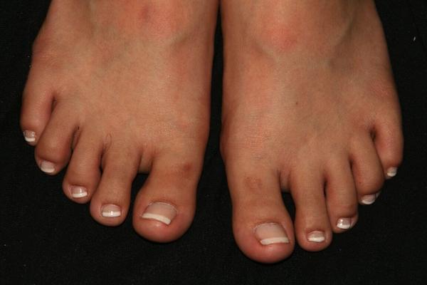 16P Pedicure PicsBarefoot,Fetish,Foot Fetish