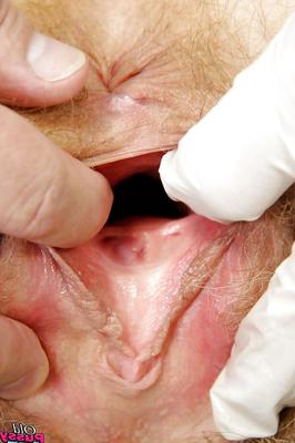 16P Mature brunette gets her hairy twat examed and toyed by gyno