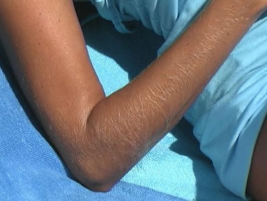 14P MILF Lori Anderson shows close up of her extremely long arm hair on the beach