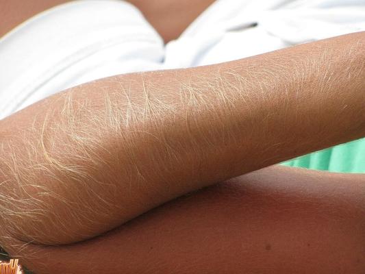 21P Skinny MILF Lori Anderson showing her hairy arms while relaxing on the beach