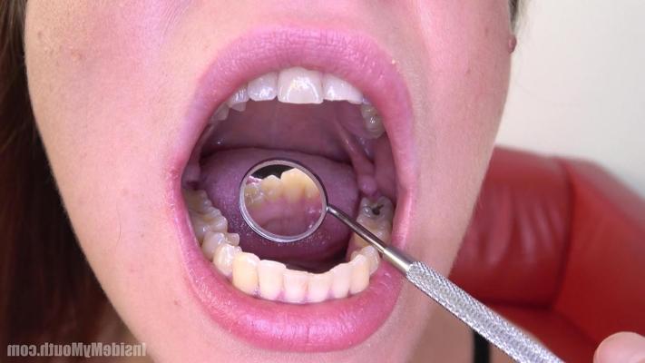 15P Inside My Mouth 