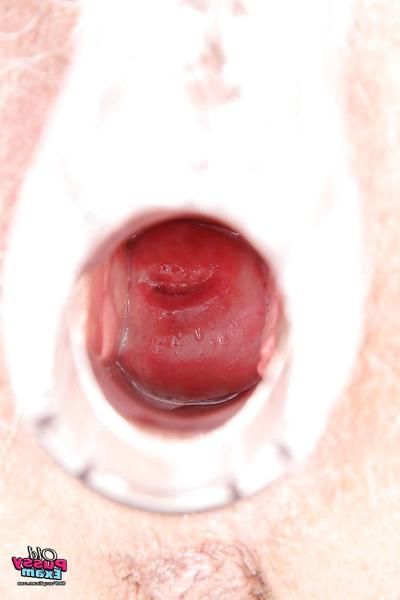 16P Lecherous mature nurse exposing her hairy twat and stuffing it with speculum