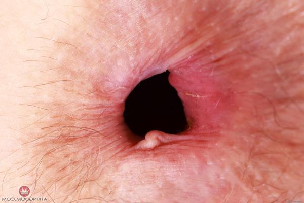 20P Beautiful amateur Jackie Hoff spreads her very hairy pussy up close