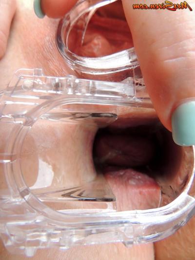17P Thick amateur Dee Siren dildo fucks her prolapsed asshole on the patio