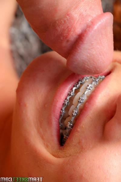 20P Curly headed teen Eli Luxx gets braces blasted with cumshot after couch sex